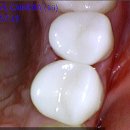 화이트디지털치과기공소 이미지