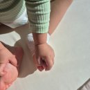 세븐일레븐 대구W병원점 | 아기 발가락 실금 및 발뒤꿈치 욕창 회복과정, 대구 W병원 진료