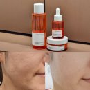 주식회사 편강한방연구소 서울 | 비타민C화장품 잡티세럼 꾸준히 바르니 화사한 피부로 재탄생
