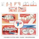 치아건강을 위해 꼭 챙겨야 하는 4가지 이미지