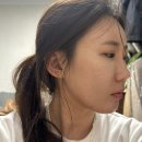 대구반월당피부과 눈밑꺼짐 해결한 효과 쥬베룩볼륨 후기