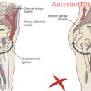 M체형교정&PT 이미지