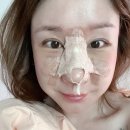 콧대높은 개 | [공지] [코보형물전체제거후기]6번째제거수술 끝 - 질문모음