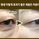 세기스템셀 이미지