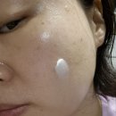 라온메디케어 이미지