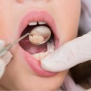 하얀플란트치과의원 이미지