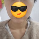 사각턱보톡스 + 윤곽주사 내돈내산 2차 후기