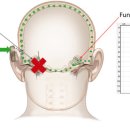 귀편한보청기 이미지