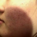 재생한의원 이미지