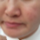 피부 관리, 라이프<b>스타일</b>마트 : 아쿠아 모공 힐러 【열심<b>맨</b> 상품기록】