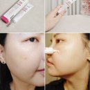 (주)디에스메디라인 | ​약국멍크림얼굴멍빨리빼는법 디에스 에프터 올인원 케이크림으로 케어해요