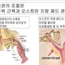 이관개방증 원인 증상 귀먹먹함 관리방법 이미지