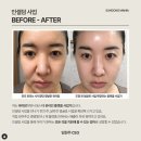 쑥쑥인셀덤