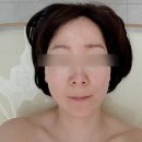 피부채움 | 영종도 피부관리 추천, 채움에스테딕 윤곽 리프팅 후기 (웨딩관리·산후관리 효과 제대로)