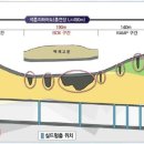 삼성지하차도 데일리안