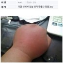 주먹구이 이미지