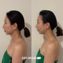 라파피부크리닉 | 풍무동 피부관리 피부샵 라파에스떼 JH윤곽술 예뻐지는 비밀