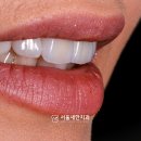 세기치과기공소 이미지