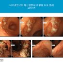 소화기병연구회