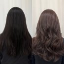 652 | 손상없이 블랙빼기 시술 후기 대전 탄방동 블랑