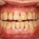 메트로치과기공소 이미지