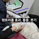 트리플 | 50대 엄마 첫 리프팅! 청담피부과 텐트리플 후기 (통증, 붓기, 주차)