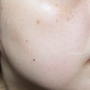 바이탈 메디컬 이미지