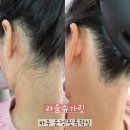 라움타워 | [라움슈가링] 파주 운정 뒷목왁싱 후기