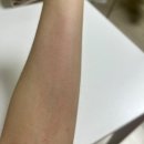 박경희 | 만성두드러기 알러지 신촌 세브란스 대학병원 검사결과 진료기록 2탄 (ft. 박경희교수님)