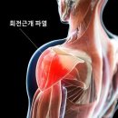 새한의원 | 갑자기 찾아오는 극심한 어깨 통증의 정체