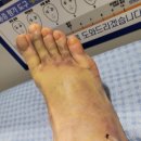 좋은아침한의원 | 구리시 좋은 아침 병원 후기