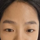 리라래쉬