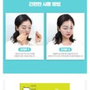 안기우안과의원 | 수원 안과. 올레이저 라섹 1일~10일차 후기