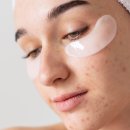 기미 없애는 방법 / 레이저 토닝, 피코레이저, IPL 치료 / 기미 치료 가격, 후기, 부작용 자세히 보기