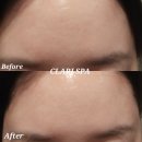 메디엑스퍼트 | 청담압구정스파에서 사용해본 트러블 크림, 바이오폭스 트러블 쉴드 솔직 후기