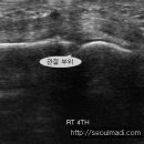 손과바늘 이미지