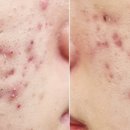 아크네마인드의원 이미지