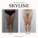 스카이라인의원 이미지