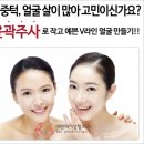 윤곽