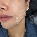 당신만의시스템 | 당신의봄의원 쿨소닉 6000샷 이중턱 고민 통증없이 해결한 후기
