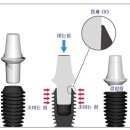(주)바이콘임플란트 이미지