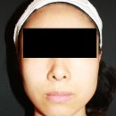 동안라인 네이버블로그