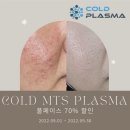 콜드플라즈마 이미지