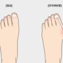 석바위 사거리 이미지