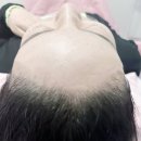 니즈헤어라인