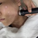 럭셔리뷰티 대구용산점 - 67089 | 대구 청소년 여드름관리 퍼나머널 뷰티 장기점에서 문제성맞춤관리 압출후기