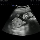 덕천보건지소 이미지