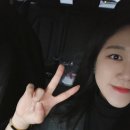 강남서연 절개 쌍수 3년 지난 솔직후기