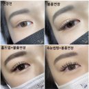 탈모왕 광주점 이미지