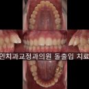 앵글치과의원 이미지